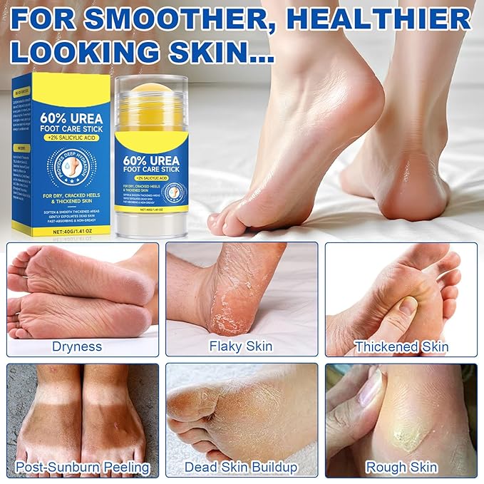 Foot Care Stick with 60% Urea 2% Salicylic Acid Aloe Vera coconut tea tree oil, Foot Callus Dead Hard Skin Remover Moisturizer for Rough Dry Cracked Feet, Knees, Elbows, Hands Repair Stick