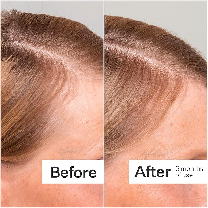 Act+Acre 3-Pack Mini Cold Processed Stem Cell Scalp Serum - Promotes Thicker, Fuller-Looking Hair - Soothes and Hydrates - Sulphate and Paraben Free - Aloe Vera for Improved Scalp Health