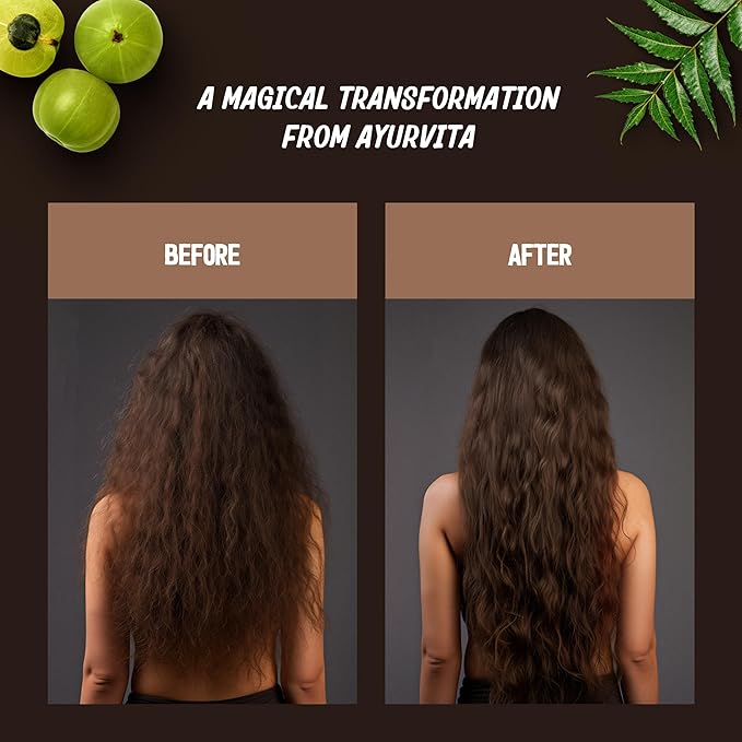 Restorative Hair Oil - Amla for Strengthening & Neem for Preventing Dryness and Dandruff - For Dry, Damaged Hair Growth - For Men & Women - 2 fl oz