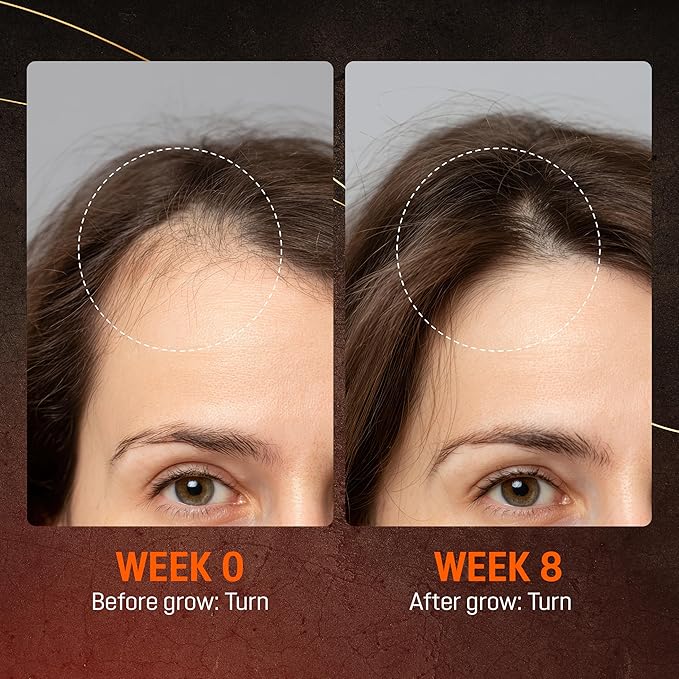 Abera Hair Growth Serum - Natural Regrowth Treatment for Hair & Beard with Biotin & Castor Oil, Economy Combo (3 Serums + Gift)